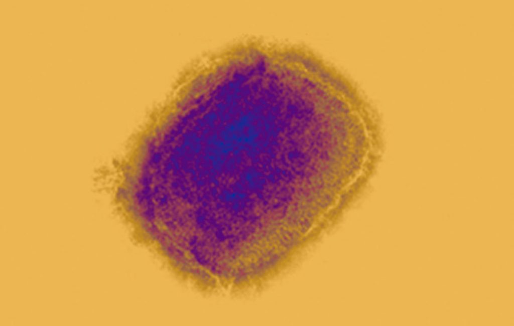 Virus verola mico